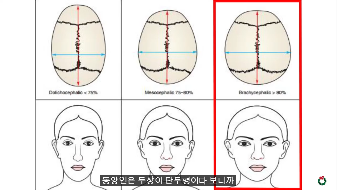 사각턱5.png